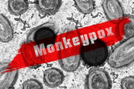 Monkey Pox | मंकी पॉक्स – कारण, लक्ष्ण, इलाज़ एवं बचाव